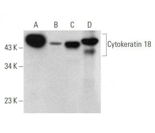 Cytokeratin 18 Antibody (LDK18) - Western Blotting - Image 353455 