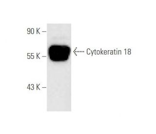 Cytokeratin 18 Antibody (RCK106) - Western Blotting - Image 56224 