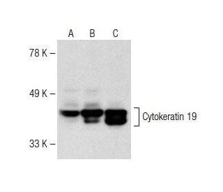 Cytokeratin 19 Antibody (A53-B/A2) - Western Blotting - Image 149546 
