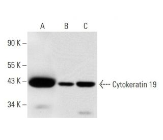 Cytokeratin 19 Antibody (B-1) - Western Blotting - Image 294564 