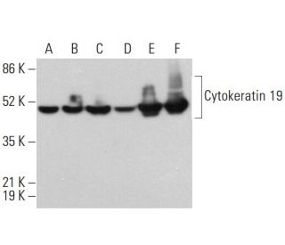 Cytokeratin 19 Antibody (BA16) - Western Blotting - Image 380640 
