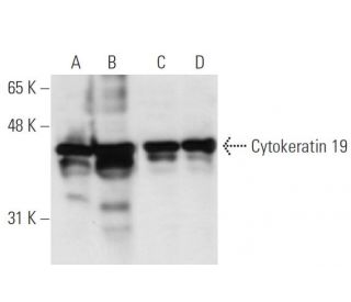 Cytokeratin 19 Antibody (BA17) - Western Blotting - Image 13600 
