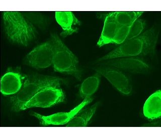 Cytokeratin 19 (RCK108) Alexa Fluor® 488: sc-53003 AF488. Direct immunofluorescence staining of formalin-fixed SW480 cells 