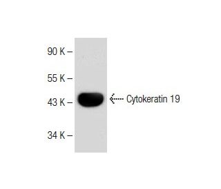 Cytokeratin 19 Antibody (F-6) - Western Blotting - Image 150225