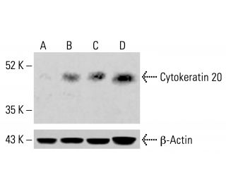 Cytokeratin 20 Antibody (E-9) - Western Blotting - Image 413895