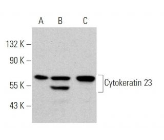 Cytokeratin 23 Antibody (C-1) - Western Blotting - Image 366177 