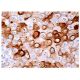 Cytokeratin 3/2p Antibody (AE5) - Immunohistochemistry - Image 159077