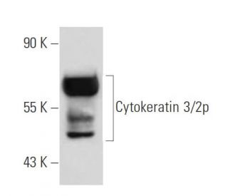 Cytokeratin 3/2p Antibody (AE5) - Western Blotting - Image 19148 