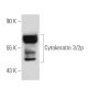 Cytokeratin 3/2p Antibody (AE5) - Western Blotting - Image 19148 