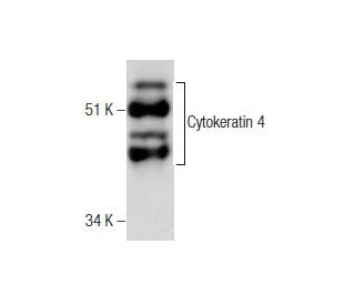 Cytokeratin 4 Antibody (0.N.344) - Western Blotting - Image 282497
