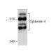 Cytokeratin 4 Antibody (0.N.344) - Western Blotting - Image 282497