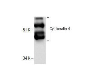 Cytokeratin 4 Antibody (5F132) - Western Blotting - Image 282495