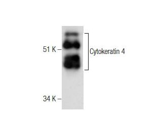 Cytokeratin 4 Antibody (6B10) - Western Blotting - Image 282494