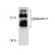 Cytokeratin 4 Antibody (6B10) - Western Blotting - Image 282494