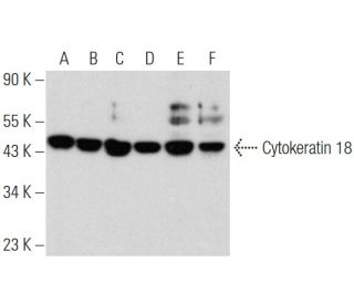 Cytokeratin 5/6/18 Antibody (0.N.345) - Western Blotting - Image 353720 