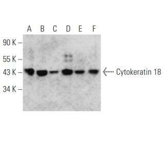 Cytokeratin 5/6/18 Antibody (3H2061) - Western Blotting - Image 353708 