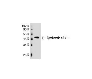 Cytokeratin 5/6/18 Antibody (LP34) - Western Blotting - Image 30646 