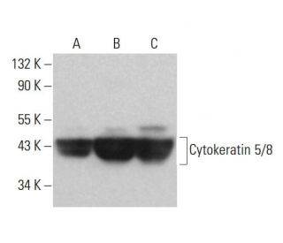 Cytokeratin 5/8 Antibody (5F295) - Western Blotting - Image 377236 