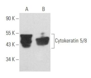 Cytokeratin 5/8 Antibody (RCK102) - Western Blotting - Image 357428 
