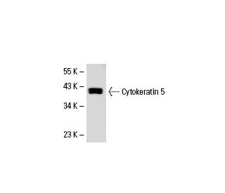 Cytokeratin 5 Antibody (3E2F1) - Western Blotting - Image 19576 