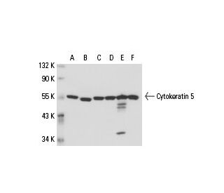 Cytokeratin 5 Antibody (AE14) - Western Blotting - Image 18172 
