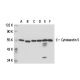 Cytokeratin 5 Antibody (AE14) - Western Blotting - Image 18172 
