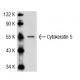 Cytokeratin 5 Antibody (AE14) - Western Blotting - Image 44403