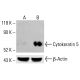 Cytokeratin 5 Antibody (AE14) - Western Blotting - Image 413357 