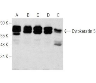 Cytokeratin 5 Antibody (G-2) - Western Blotting - Image 354681 