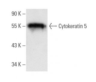 Cytokeratin 5 Antibody (RCK103) - Western Blotting - Image 9889 