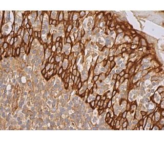 Cytokeratin 6/75 Antibody (H-6) - Immunohistochemistry - Image 387495 