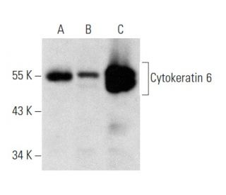 Cytokeratin 6 Antibody (B-7) - Western Blotting - Image 358378 