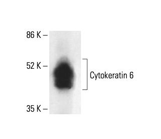 Cytokeratin 6 Antibody (LL020) - Western Blotting - Image 411933