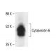 Cytokeratin 6 Antibody (LL020) - Western Blotting - Image 411933
