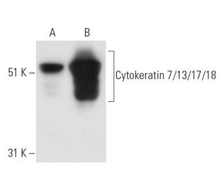 Cytokeratin 7/13/17/18 Antibody (LdS 23) - Western Blotting - Image 16437 
