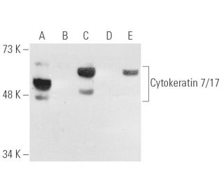 Cytokeratin 7/17 Antibody (C46) - Western Blotting - Image 5349 