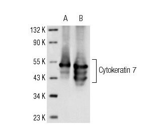 Cytokeratin 7 Antibody (LP1K) - Western Blotting - Image 12686 