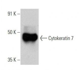 Cytokeratin 7 Antibody (LP5K) - Western Blotting - Image 356325 