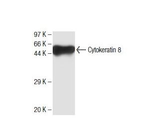Cytokeratin 8 Antibody (19) - Western Blotting - Image 136756 