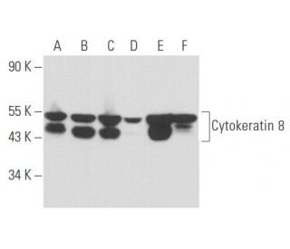Cytokeratin 8 Antibody (1E8-C6-B4) - Western Blotting - Image 357398 