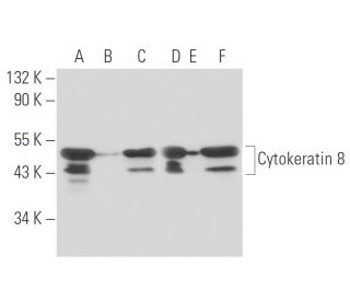 Cytokeratin 8 Antibody (1E8) - Western Blotting - Image 15572 