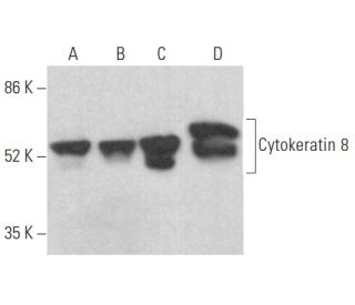 Cytokeratin 8 Antibody (A-9) - Western Blotting - Image 354450 