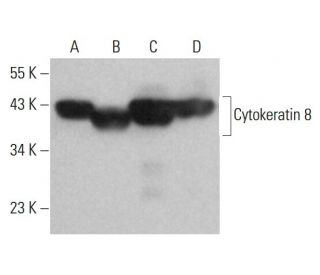 Cytokeratin 8 Antibody (C51) - Western Blotting - Image 377235 