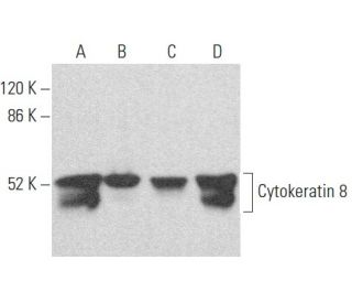 Cytokeratin 8 Antibody (E-12) - Western Blotting - Image 354455 