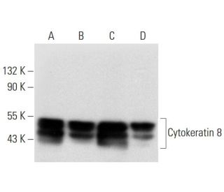 Cytokeratin 8 Antibody (H-11) - Western Blotting - Image 294567 