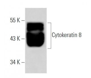 Cytokeratin 8 Antibody (Ks8.7) - Western Blotting - Image 22119 