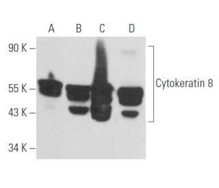 Cytokeratin 8 Antibody (LP3K) - Western Blotting - Image 357397 