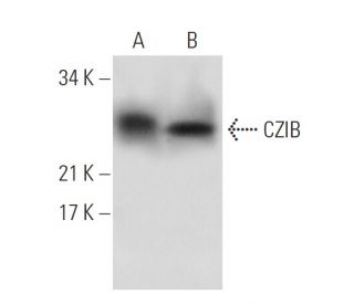 CZIB Antibody (H-9) - Western Blotting - Image 288620 