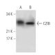 CZIB Antibody (H-9) - Western Blotting - Image 288620 