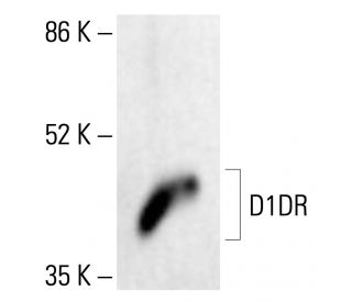 D1DR/Dopamine Receptor D1 Antibody (A-1) - Western Blotting - Image 411993